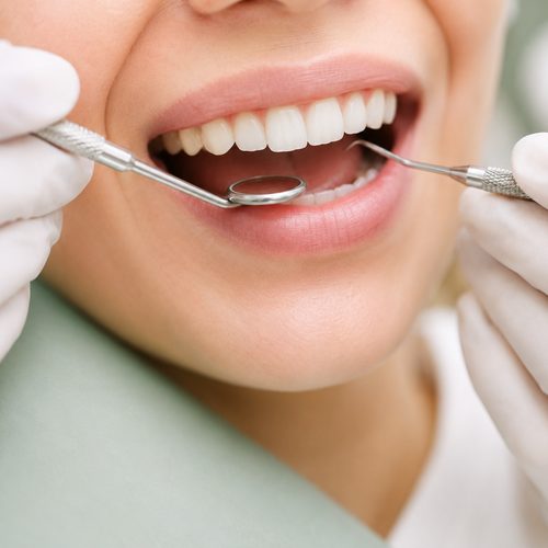 Dentist examining a patient's smile with mirror and explorer